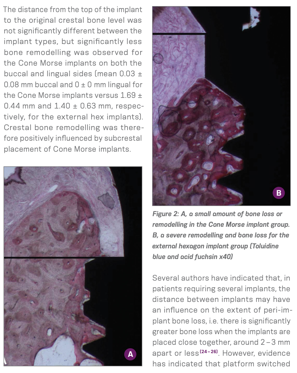 Narrative Review on Clinical Advantages of the Neodent® Morse Taper Connection